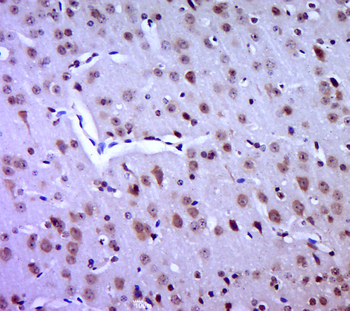 SOCS3 Rabbit Polyclonal Antibody