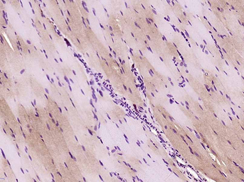 SOCS3 Rabbit Polyclonal Antibody