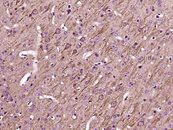 UCP-2 Rabbit Polyclonal Antibody