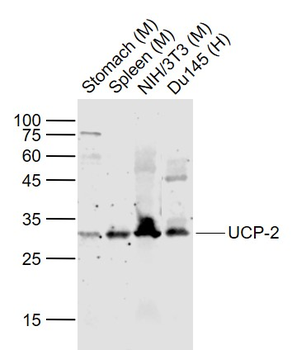 UCP-2 Rabbit Polyclonal Antibody