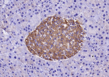 GPR49/LGR5 Rabbit Polyclonal Antibody