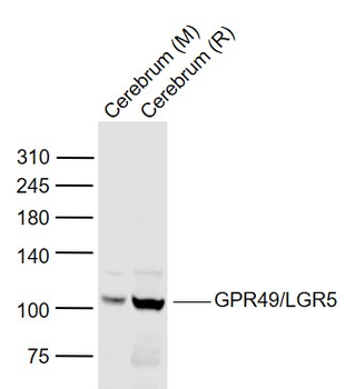 GPR49/LGR5 Rabbit Polyclonal Antibody