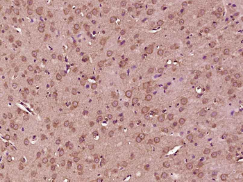 AMPK alpha-1 Mouse Monoclonal Antibody