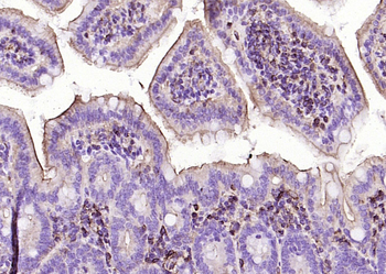 Beta-Actin Mouse Monoclonal Antibody (Loading Control)