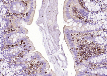 Beta-Actin Mouse Monoclonal Antibody (Loading Control)