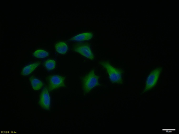 Beta tubulin Mouse Monoclonal Antibody (Loading Control)