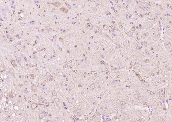 Beta tubulin Mouse Monoclonal Antibody (Loading Control)