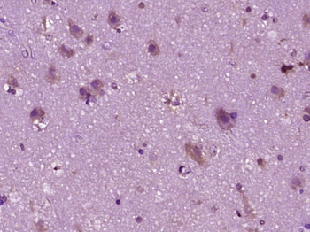 Phospho-GNA12 (Ser40) Rabbit Polyclonal Antibody