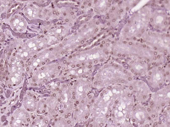 USP15 Rabbit Polyclonal Antibody