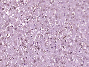USP15 Rabbit Polyclonal Antibody
