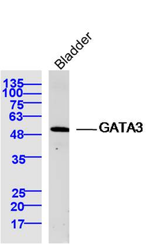 GATA3 Rabbit Polyclonal Antibody