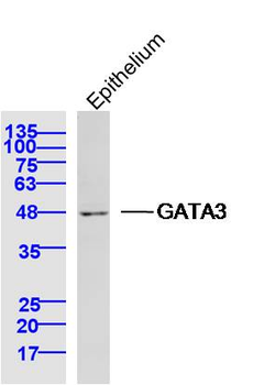 GATA3 Rabbit Polyclonal Antibody