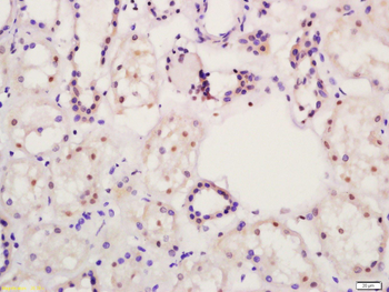 PPAR alpha Rabbit Polyclonal Antibody