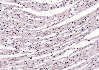 Beclin 1 Mouse Monoclonal Antibody