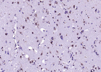 Beclin 1 Mouse Monoclonal Antibody