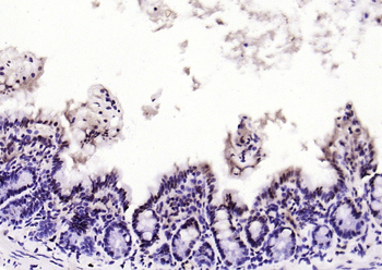 Beclin 1 Mouse Monoclonal Antibody