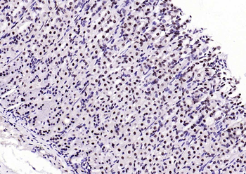 Beclin 1 Mouse Monoclonal Antibody