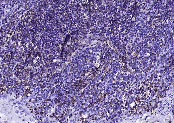 Vimentin Mouse Monoclonal Antibody