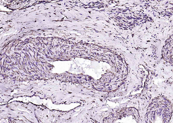 Vimentin Mouse Monoclonal Antibody