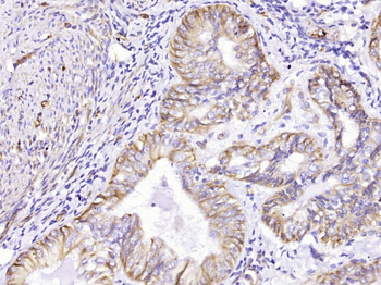 Vimentin Mouse Monoclonal Antibody