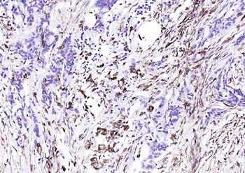 Vimentin Mouse Monoclonal Antibody