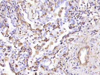 Vimentin Mouse Monoclonal Antibody