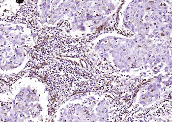 Vimentin Mouse Monoclonal Antibody