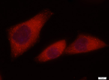 CK18 Mouse Monoclonal Antibody
