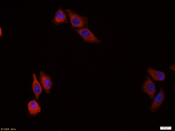 CK18 Mouse Monoclonal Antibody