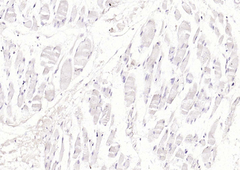 CK18 Mouse Monoclonal Antibody