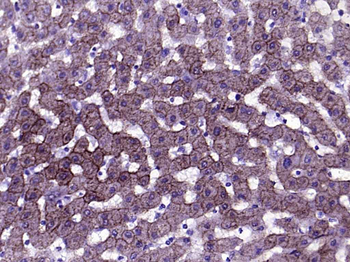 CK18 Mouse Monoclonal Antibody