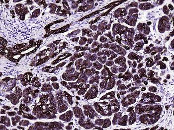 CK18 Mouse Monoclonal Antibody
