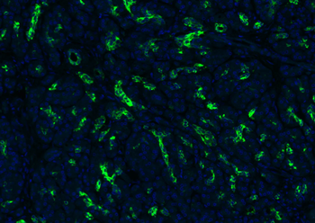 CK18 Mouse Monoclonal Antibody