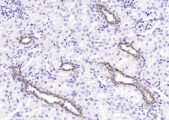 CK18 Mouse Monoclonal Antibody