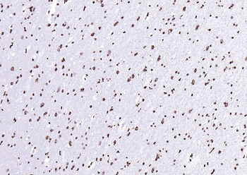 Histone H3 (di methyl K27) Mouse Monoclonal Antibody