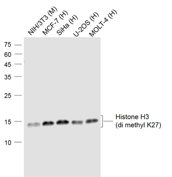 Histone H3 (di methyl K27) Mouse Monoclonal Antibody