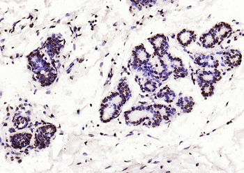 Histone H3 (di methyl K27) Mouse Monoclonal Antibody