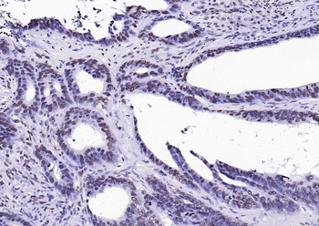 Histone H3 (di methyl K27) Mouse Monoclonal Antibody