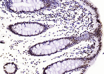 Histone H3 (di methyl K27) Mouse Monoclonal Antibody