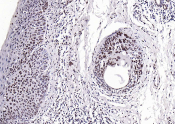 Histone H3 (di methyl K27) Mouse Monoclonal Antibody
