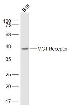 MC1R Rabbit Polyclonal Antibody