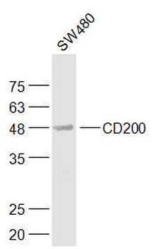 CD200 Rabbit Polyclonal Antibody
