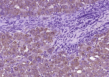 SOD2 Rabbit Polyclonal Antibody