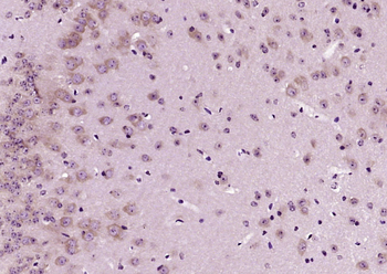 SOD2 Rabbit Polyclonal Antibody