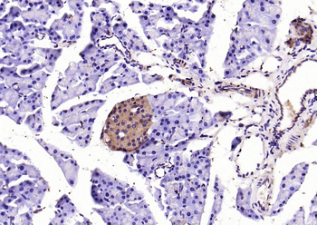 SOD2 Rabbit Polyclonal Antibody