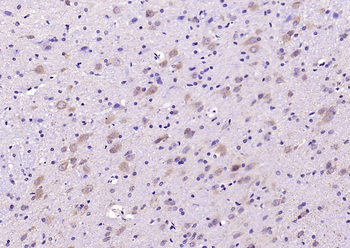 SOD2 Rabbit Polyclonal Antibody
