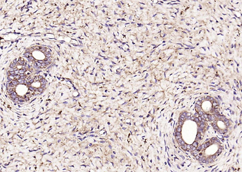 SOD2 Rabbit Polyclonal Antibody