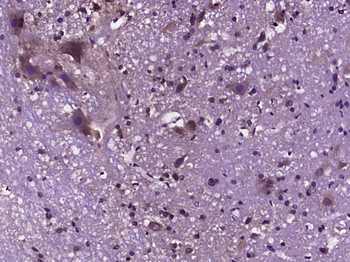 TRPV1 Rabbit Polyclonal Antibody