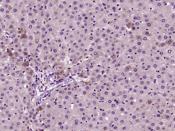 Arginase 1 Rabbit Polyclonal Antibody