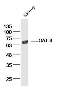 OAT-3 Rabbit Polyclonal Antibody